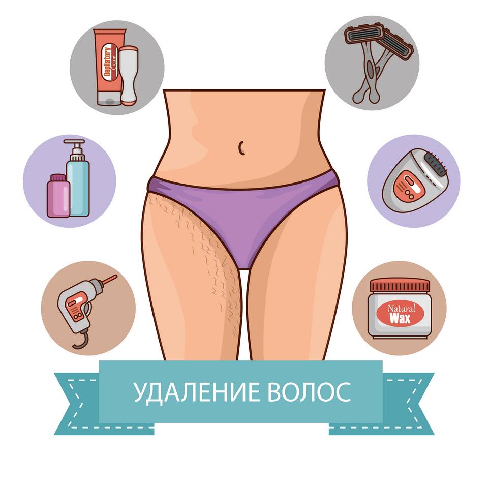 Как правильно подавать эпиляцию
